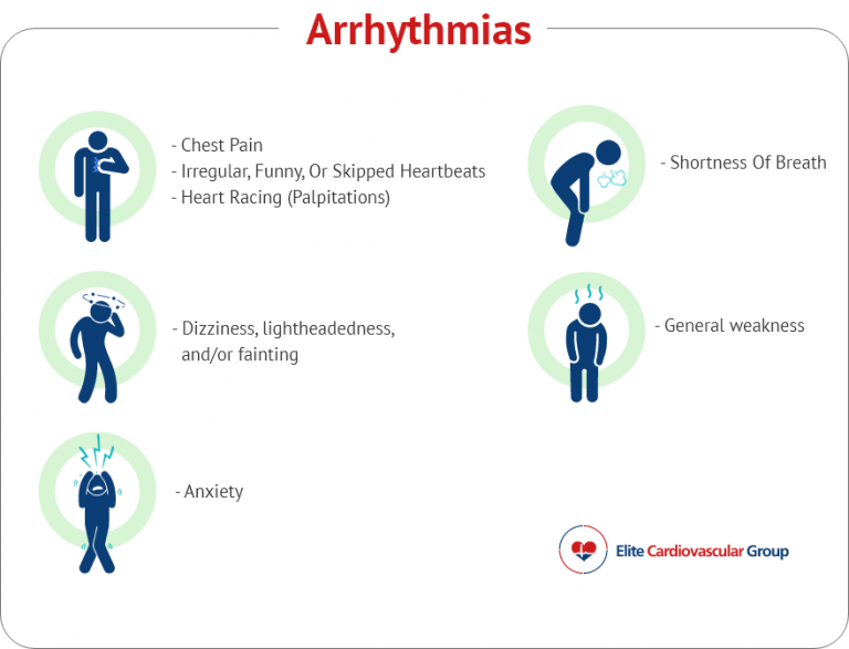 arrhythmia symptoms