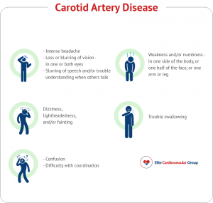 Carotid Artery Disease - Elite Cardiovascular Group