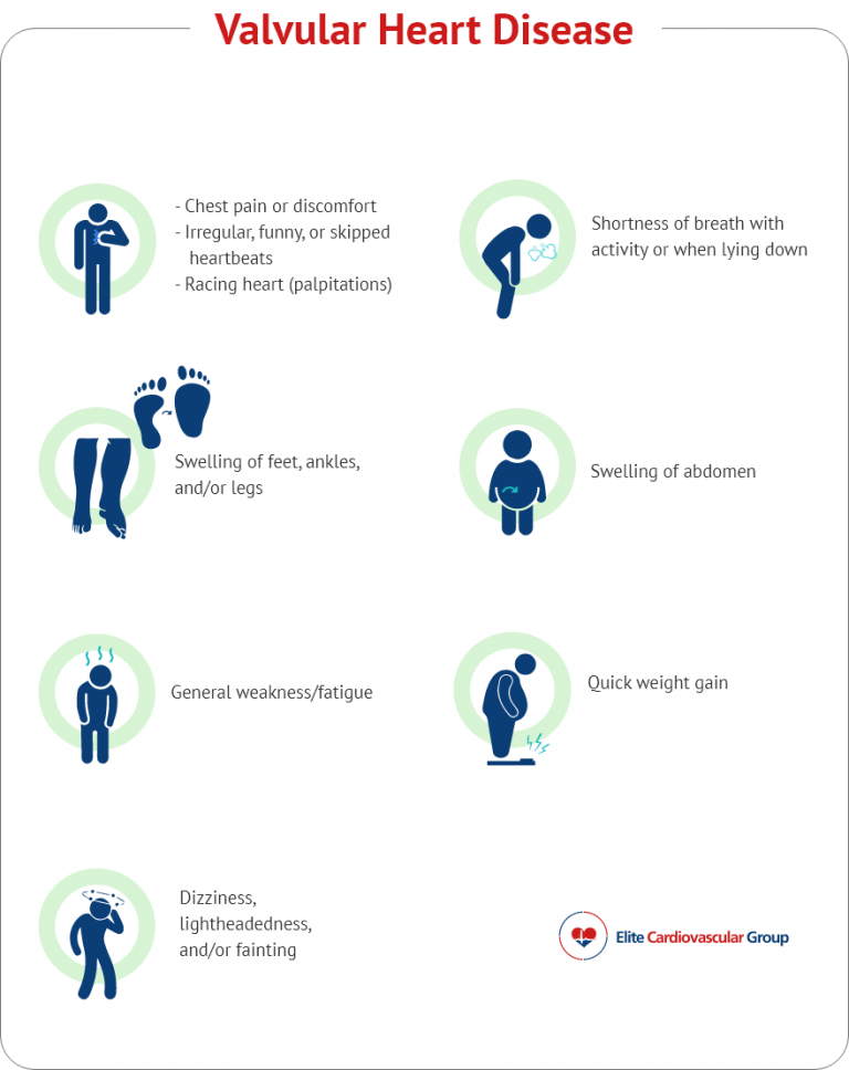 Valvular Heart Disease Elite Cardiovascular Group